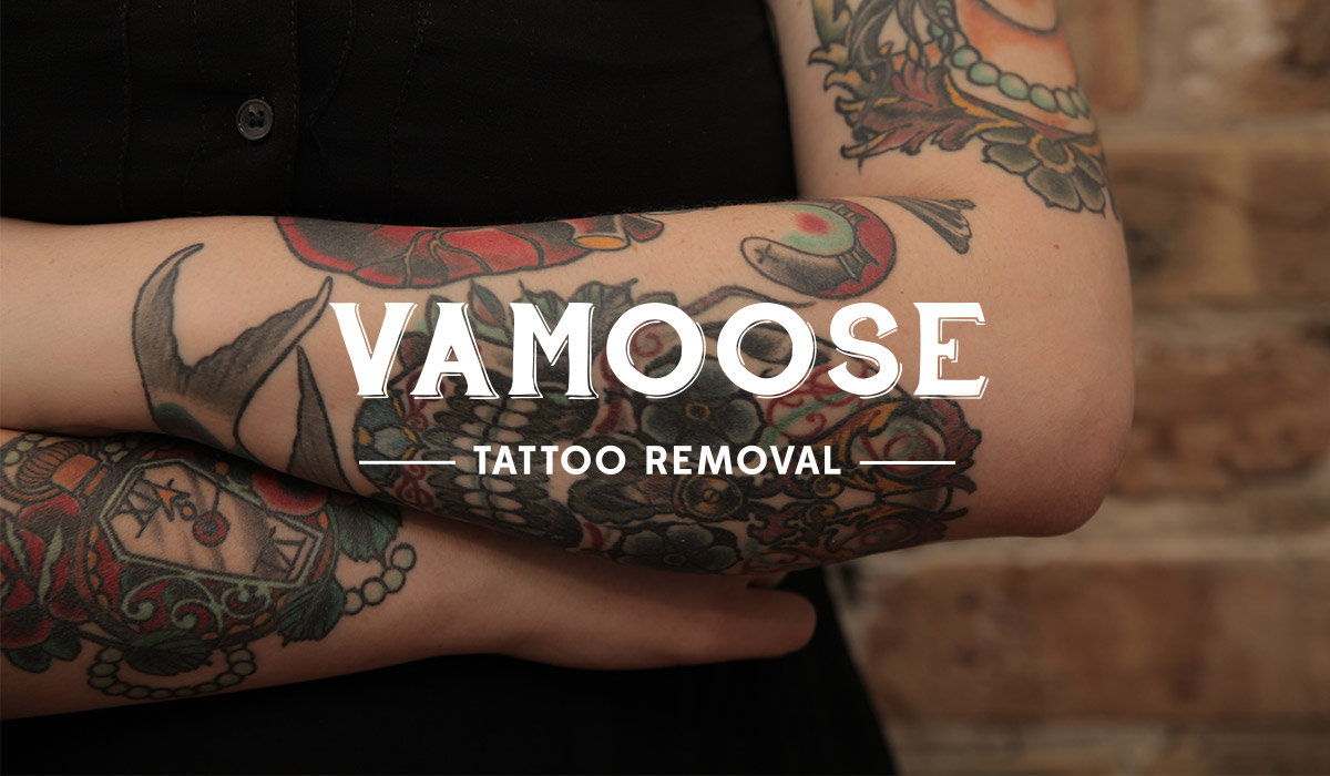 Introducing Vamoose Tattoo Removal